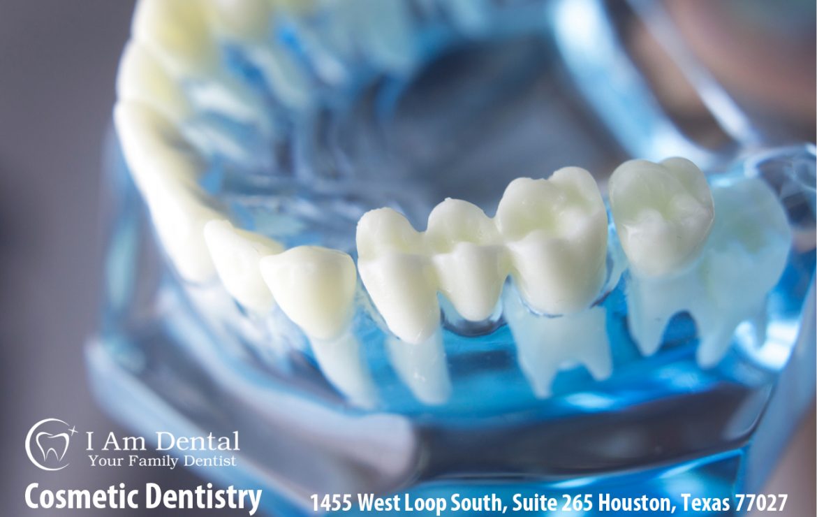 Dental Implants | Surgery, Advantages, Risks, and Insurance.